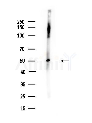 ENOSF1 Antibody - Western blot analysis of lysates from A375 cells(LPS,4h treatment), using ENOSF1 Antibody at 1/1000 dilution.