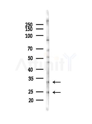 SCGN Antibody - Western blot analysis of lysates from COLO205 cells(heat-shock,45min treatment), using SCGN Antibody at 1/1000 dilution.
