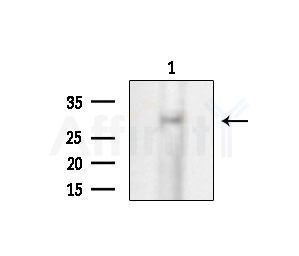 CREG1 Antibody - Western blot analysis of extracts from EC304 cells, using CREG1 Antibody at 1/1000 dilution.