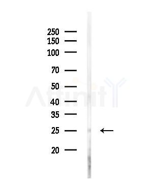 CREG1 Antibody - Western blot analysis of lysates from EC304 cells, using CREG1 Antibody at 1/1000 dilution.