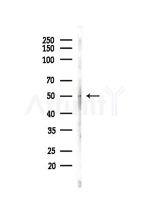 HTR3C Antibody - Western blot analysis of lysates from HepG2 cells(LPS,4h treatment), using HTR3C Antibody at 1/1000 dilution.