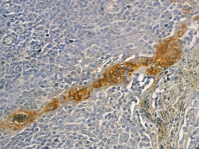 BAI2 Antibody - DF10200 at 1/100 staining human normal lung tissue by IHC-P.