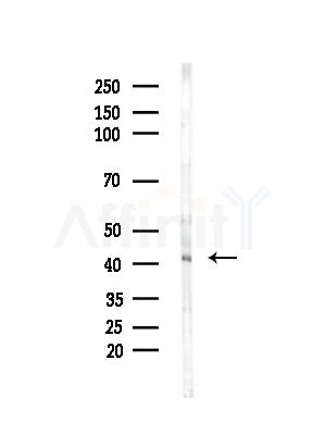 CCR4 Antibody - Western blot analysis of lysates from Mouse brain, using CCR4 Antibody at 1/1000 dilution.