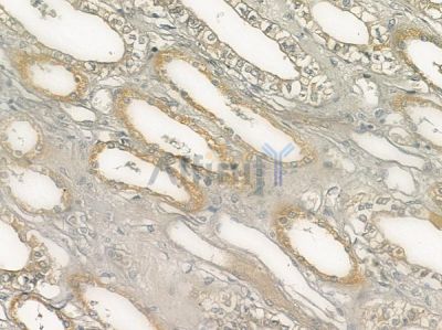 CCR4 Antibody - DF10206 at 1/100 staining human normal kidney tissue by IHC-P.