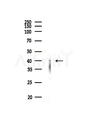 C5R1 Antibody - Western blot analysis of lysates from RAW264.