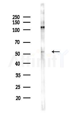 DRD2 Antibody - Western blot analysis of lysates from Hela cells(LPS 4h treatment), using DRD2 Antibody at 1/1000 dilution.