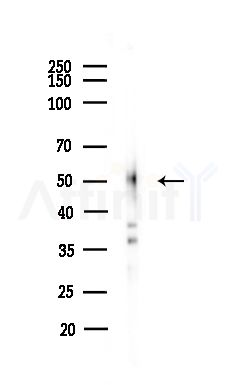 GLP2R Antibody - Western blot analysis of lysates from MCF7 cells(heat-shock,45min treatment), using GLP2R Antibody at 1/1000 dilution.
