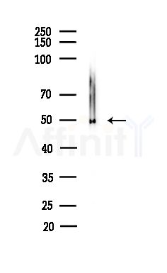 GLP2R Antibody - Western blot analysis of lysates from Mouse testis, using GLP2R Antibody at 1/1000 dilution.