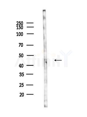 GPR85 Antibody - Western blot analysis of lysates from A375 cells(heat-shock,45min treatment), using GPR85 Antibody at 1/1000 dilution.