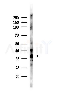 LT4R1 Antibody - Western blot analysis of lysates from MCF7 cells(heat-shock,45min treatment), using LT4R1 Antibody at 1/1000 dilution.