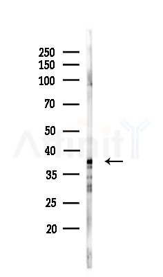 LT4R1 Antibody - Western blot analysis of lysates from COLO205 cells(UV,30min treatment), using LT4R1 Antibody at 1/1000 dilution.