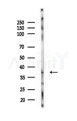 LT4R1 Antibody - Western blot analysis of lysates from Rat lung, using LT4R1 Antibody at 1/1000 dilution.