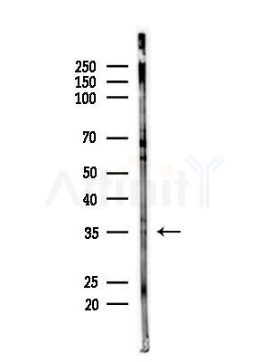 OR10H5 Antibody - Western blot analysis of lysates from Hela cells(starvation,24h treatment), using OR10H5 Antibody at 1/1000 dilution.