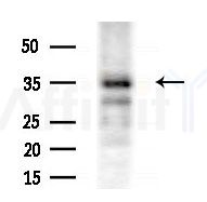 OR13J1 Antibody - Western blot analysis of extracts from HepG2 cells(starvation treatment), using OR13J1 Antibody at 1/1000 dilution.