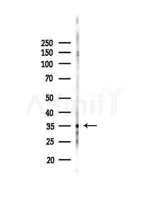 OR4C46 Antibody - Western blot analysis of lysates from EC304 cells(heat-shock,45min treatment), using OR4C46 Antibody at 1/1000 dilution.