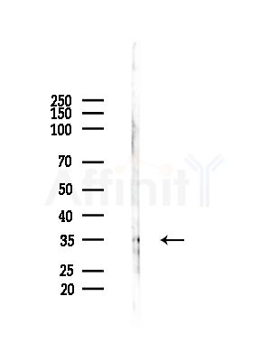 OR4F15 Antibody - Western blot analysis of lysates from HepG2 cells(LPS,4h treatment), using OR4F15 Antibody at 1/1000 dilution.