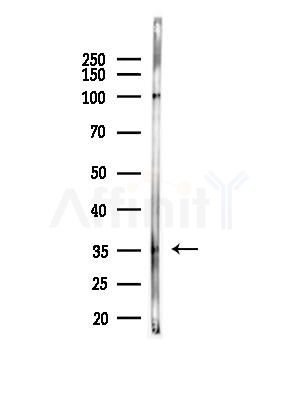 OR52J3 Antibody - Western blot analysis of lysates from B16F10-LUC cells(heat-shock,45min treatment), using OR52J3 Antibody at 1/1000 dilution.