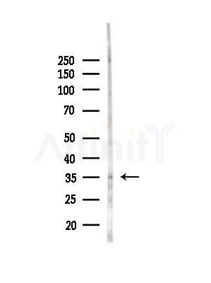 OR56B2 Antibody - Western blot analysis of lysates from EC304 cells(heat-shock,45min treatment), using OR56B2 Antibody at 1/1000 dilution.