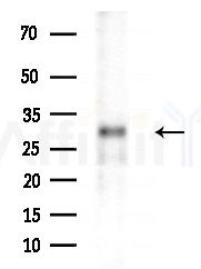 OR10P1 Antibody - Western blot analysis of extracts from HepG2 cells(starvation treatment), using OR10P1 Antibody at 1/1000 dilution.