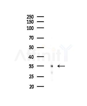 OR1E1 Antibody - Western blot analysis of lysates from EC304 cells, using OR1E1 Antibody at 1/1000 dilution.