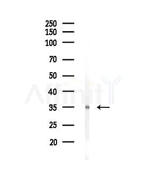 OR1E1 Antibody - Western blot analysis of lysates from COLO205 cells, using OR1E1 Antibody at 1/1000 dilution.