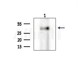 OR2B6 Antibody - Western blot analysis of extracts from EC304 cells, using OR2B6 Antibody at 1/1000 dilution.