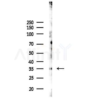 OR2B6 Antibody - Western blot analysis of lysates from EC304 cells, using OR2B6 Antibody at 1/1000 dilution.