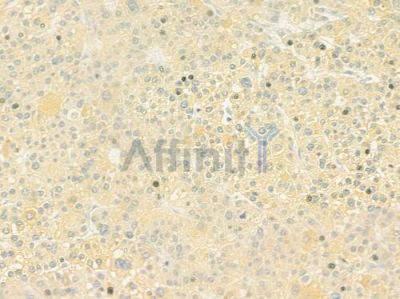OR2B6 Antibody - DF10245 at 1/100 staining human normal liver tissue by IHC-P.