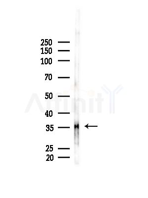 OR4D5 Antibody - Western blot analysis of lysates from B16F10-LUC cells(LPS, 4h treatment), using OR4D5 Antibody at 1/1000 dilution.