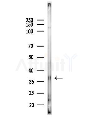 OR5T3 Antibody - Western blot analysis of lysates from PC12 cells(LPS,4h treatment), using OR5T3 Antibody at 1/1000 dilution.