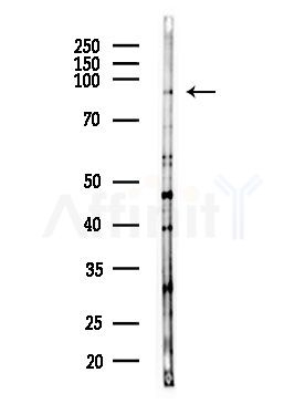 RXFP1 Antibody - Western blot analysis of lysates from MDA-MB-231 cells(heat-shock,45min treatment), using RXFP1 Antibody at 1/1000 dilution.