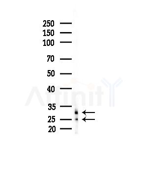 TAS2R12 Antibody - Western blot analysis of lysates from RAW264.