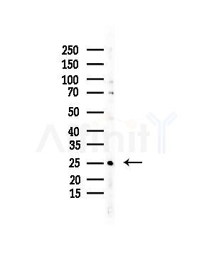 TAS2R12 Antibody - Western blot analysis of lysates from Rat liver, using TAS2R12 Antibody at 1/1000 dilution.