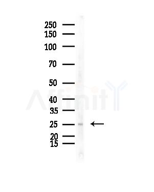 TAS2R12 Antibody - Western blot analysis of lysates from Mouse lung, using TAS2R12 Antibody at 1/1000 dilution.