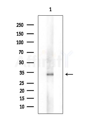 TAS2R40 Antibody - Western blot analysis of extracts from COLO205 cells, using TAS2R40 Antibody at 1/1000 dilution.