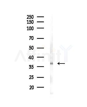 TAS2R40 Antibody - Western blot analysis of lysates from COLO205 cells, using TAS2R40 Antibody at 1/1000 dilution.