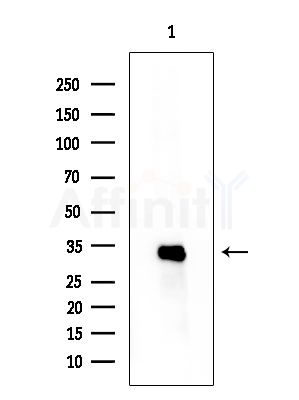 TAS2R9 Antibody - Western blot analysis of extracts from EC304 cells, using TAS2R9 Antibody at 1/1000 dilution.