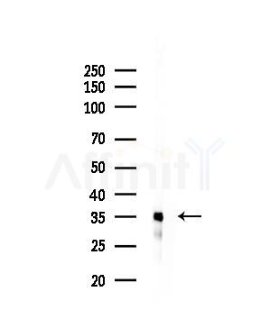 TAS2R9 Antibody - Western blot analysis of lysates from EC304 cells, using TAS2R9 Antibody at 1/1000 dilution.