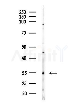 OR11A1 Antibody - Western blot analysis of lysates from MDA-MB-231 cells(heat-shock,45min treatment), using OR11A1 Antibody at 1/1000 dilution.