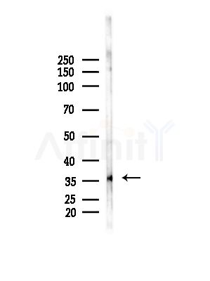 OR52N2 Antibody - Western blot analysis of lysates from B16F10-LUC cells(LPS, 4h treatment), using OR52N2 Antibody at 1/1000 dilution.
