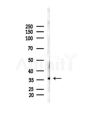 OR52N5 Antibody - Western blot analysis of lysates from B16F10-LUC cells(LPS, 4h treatment), using OR52N5 Antibody at 1/1000 dilution.