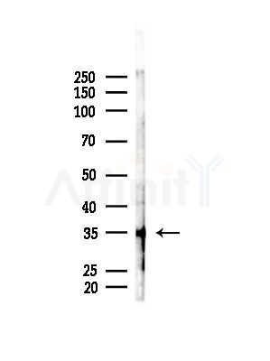 OR52P1 Antibody - Western blot analysis of lysates from B16F10-LUC cells(LPS, 4h treatment), using OR52P1 Antibody at 1/1000 dilution.