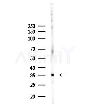 OR52R1 Antibody - Western blot analysis of lysates from EC304 cells, using OR52R1 Antibody at 1/1000 dilution.