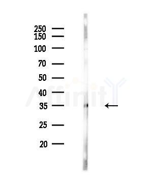 OR1C1 Antibody - Western blot analysis of lysates from A549 cells(heat-shock,45min treatment), using OR1C1 Antibody at 1/1000 dilution.