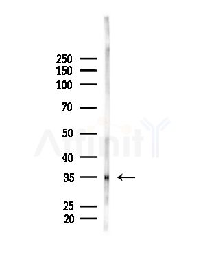 OR2L2 Antibody - Western blot analysis of lysates from B16F10-LUC cells(LPS, 4h treatment), using OR2L2 Antibody at 1/1000 dilution.