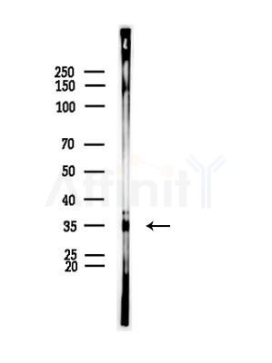 TAS2R42 Antibody - Western blot analysis of lysates from Mouse muscle, using TAS2R42 Antibody at 1/1000 dilution.