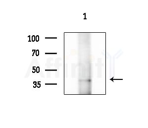 TAS2R44 Antibody - Western blot analysis of extracts from 293 cells(starvation treatment), using TAS2R44 Antibody at 1/1000 dilution.