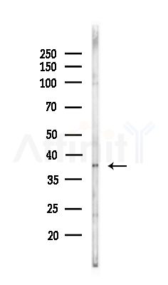 U12 Antibody - Western blot analysis of lysates from COLO205 cells(UV,30min treatment), using U12 Antibody at 1/1000 dilution.
