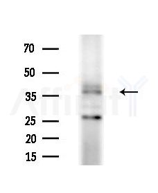 HCG39951 Antibody - Western blot analysis of extracts from 293 cells(starvation treatment), using HCG39951 Antibody at 1/1000 dilution.