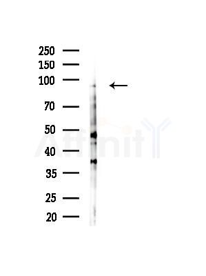 PKD2 Antibody - Western blot analysis of lysates from EC304 cells(heat-shock, 45min treatment), using PKD2 Antibody at 1/1000 dilution.